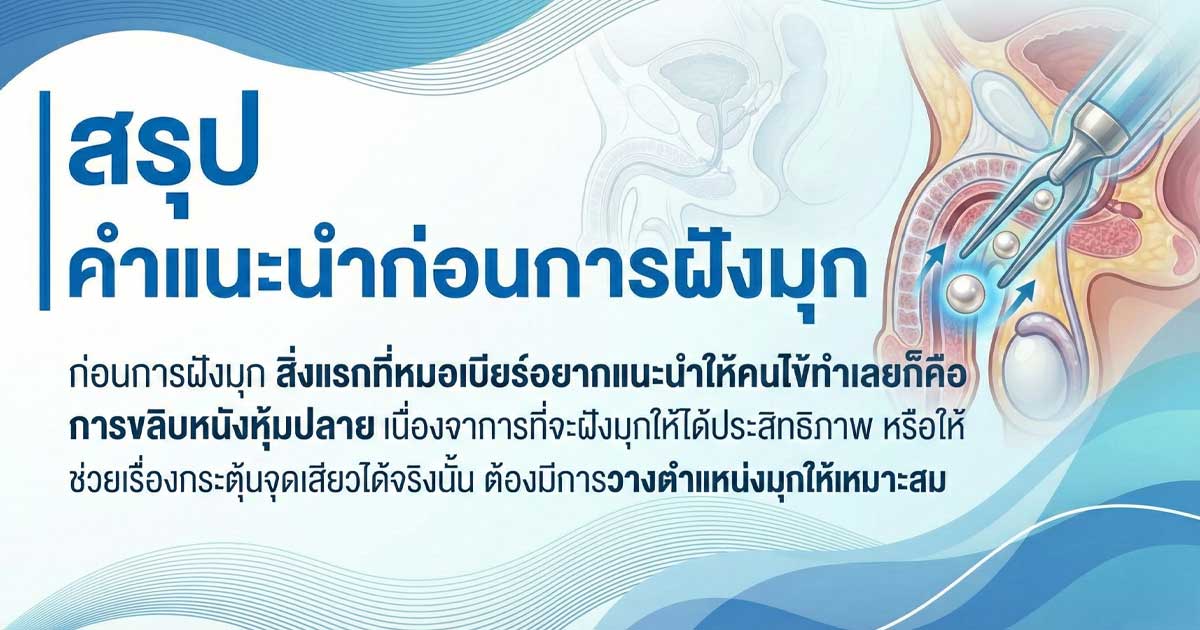 dffsim - ETERNITY CLINIC นพ.สืบพงษ์ เอ่งฉ้วน คำแนะนำก่อนการฝังมุก