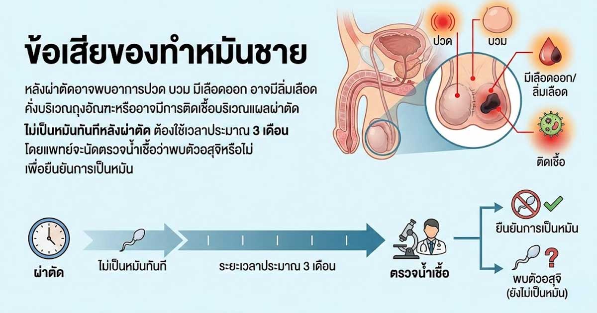 dfgz - ETERNITY CLINIC นพ.สืบพงษ์ เอ่งฉ้วน ข้อเสียของทำหมันชาย