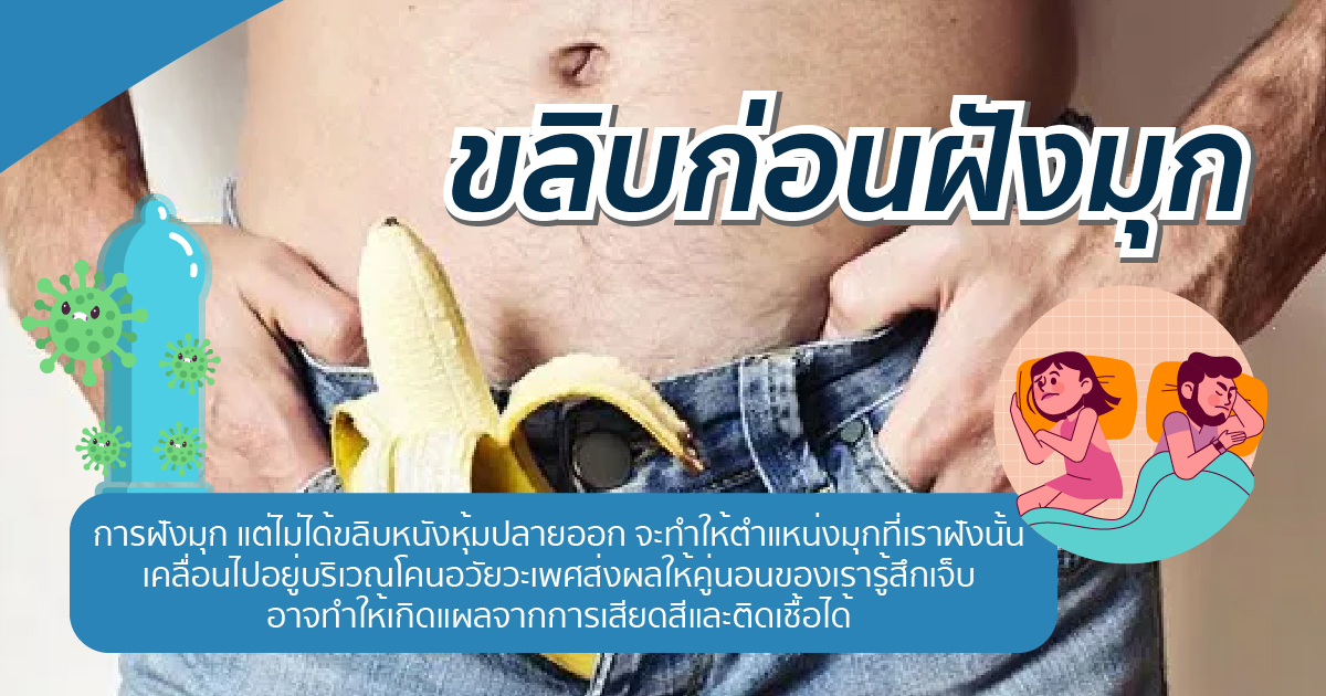 dfxxx - ETERNITY CLINIC นพ.สืบพงษ์ เอ่งฉ้วน ขลิบก่อนฝังมุก
