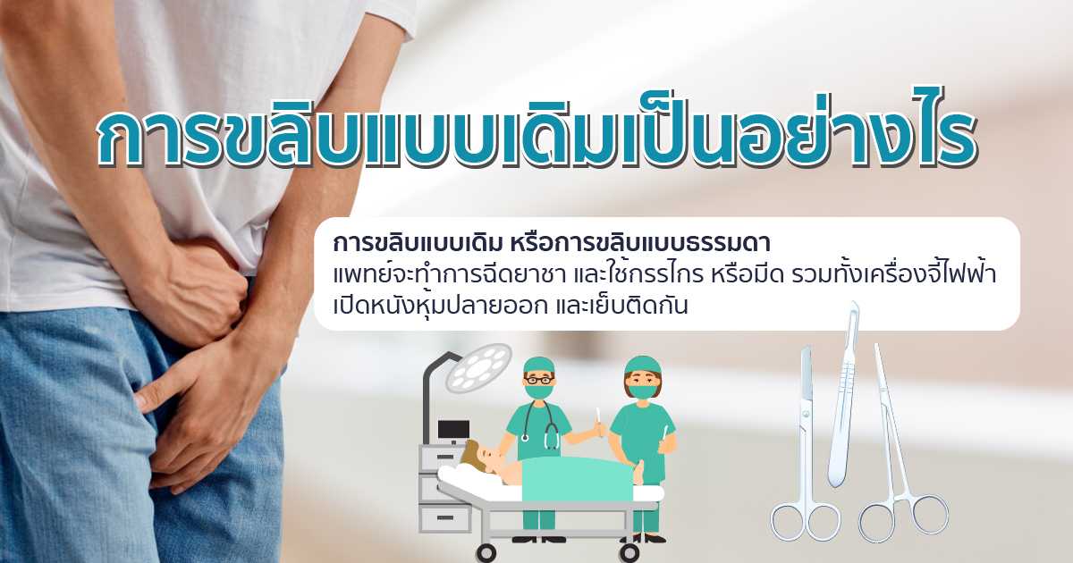 bod 19.3 - ETERNITY CLINIC นพ.สืบพงษ์ เอ่งฉ้วน การขลิบแบบเดิมเป็นอย่างไร