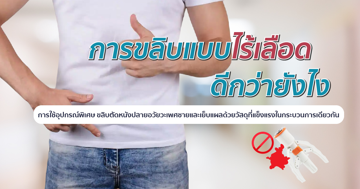 bod 19.4 - ETERNITY CLINIC นพ.สืบพงษ์ เอ่งฉ้วน การขลิบไร้เลือด ดีกว่ายังไง