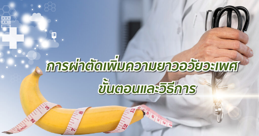 การผ่าตัดเพิ่มความยาวอวัยวะเพศ ขั้นตอนและวิธีการ - ETERNITY CLINIC นพ.สืบพงษ์ เอ่งฉ้วน