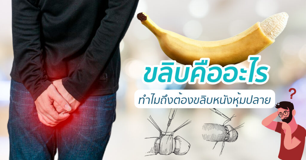 ขลิบคืออะไร ทำไมถึงต้องขลิบหนังหุ้มปลาย - ETERNITY CLINIC นพ.สืบพงษ์ เอ่งฉ้วน ขลิบคืออะไร ทำไมถึงต้องขลิบหนังหุ้มปลาย หมอเบียร์ ETERNITY CLINIC