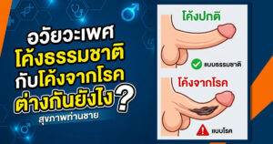 น้องชายโค้ง ผิดปกติไหม