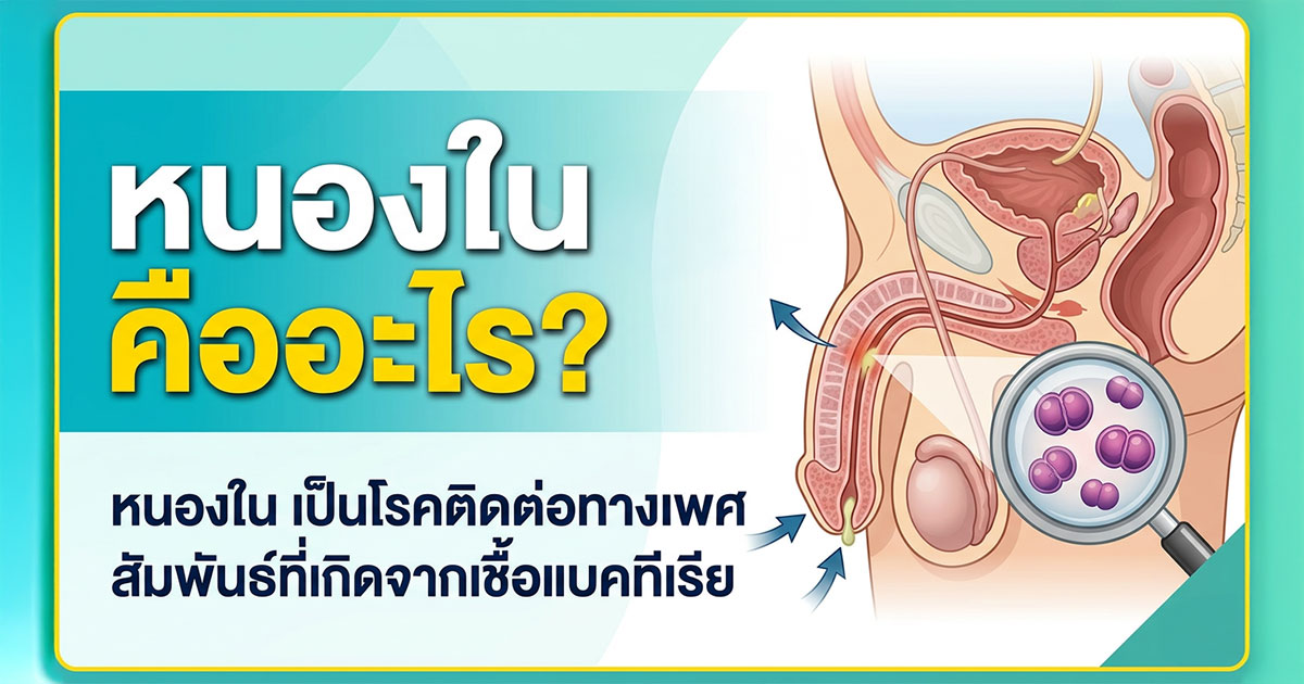 หนองในคืออะไร