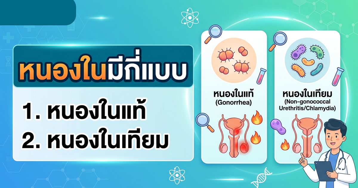 xc - ETERNITY CLINIC นพ.สืบพงษ์ เอ่งฉ้วน หนองในมีกี่แบบ