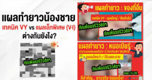 เทคนิคเเผล VY