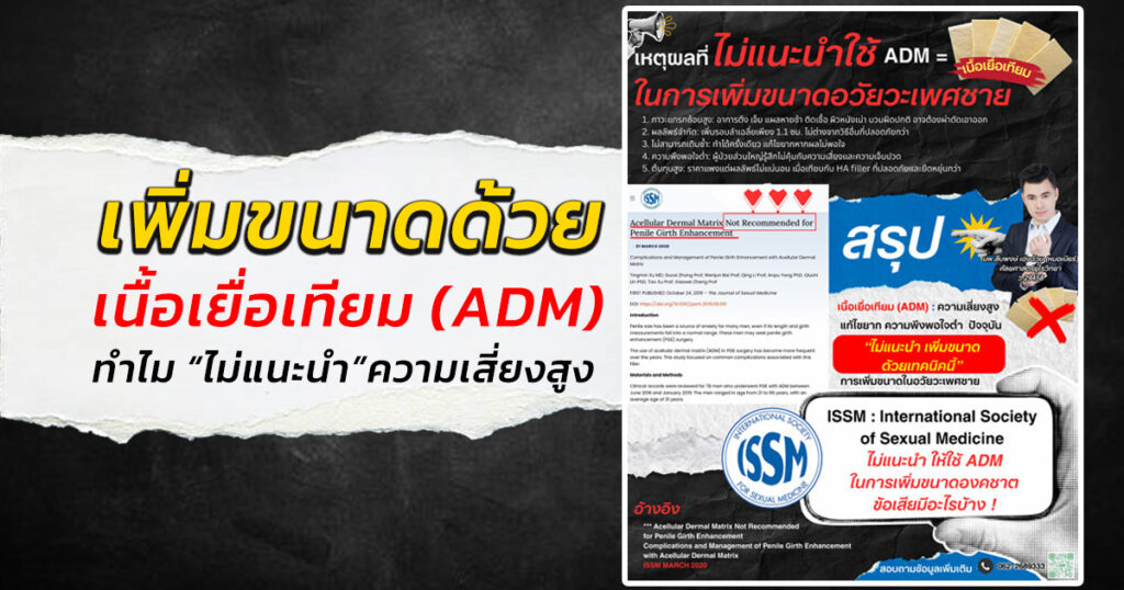 er - ETERNITY CLINIC นพ.สืบพงษ์ เอ่งฉ้วน วิธีเพิ่มขนาดน้องชาย