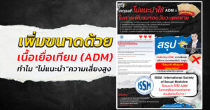 วิธีเพิ่มขนาดน้องชาย