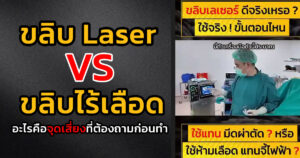 ขลิบมีกี่เเบบ