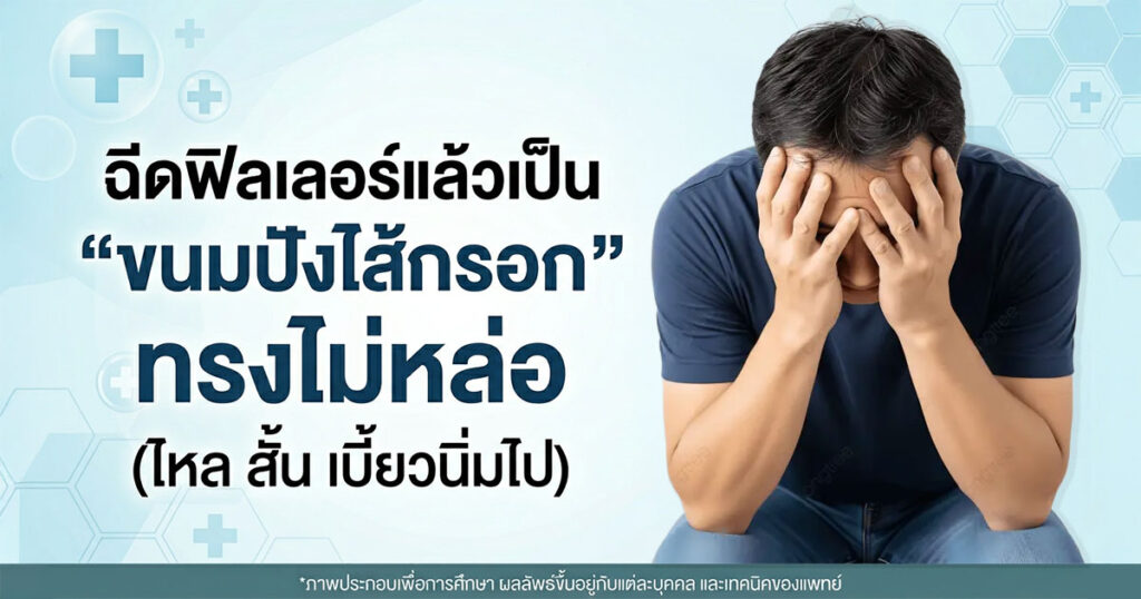 fv - ETERNITY CLINIC นพ.สืบพงษ์ เอ่งฉ้วน ฉีดฟิลเลอร์น้องชาย