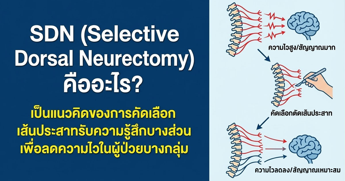 fvc - ETERNITY CLINIC นพ.สืบพงษ์ เอ่งฉ้วน วิธีลดความไวหัวองคชาต