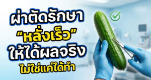 รักษาหลั่งเร็ว