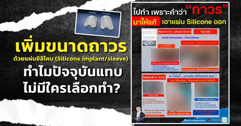 vb - ETERNITY CLINIC นพ.สืบพงษ์ เอ่งฉ้วน เพิ่มขนาดชายถาวร