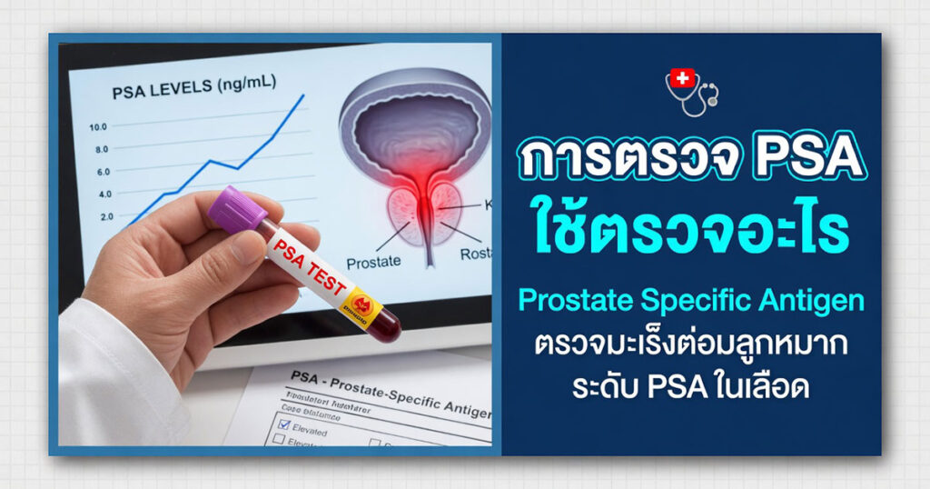 PSA- - ETERNITY CLINIC นพ.สืบพงษ์ เอ่งฉ้วน การตรวจ PSA ตรวจหาอะไร
