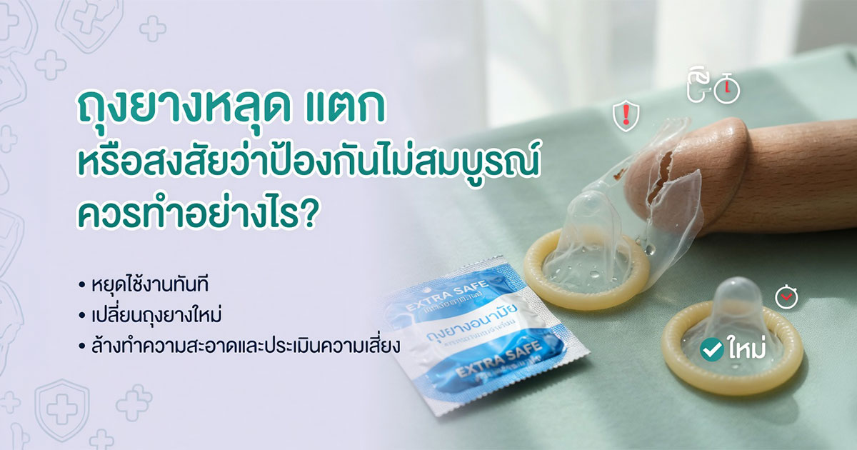ถุงยางหลุดหรือแตกควรทำอย่างไร