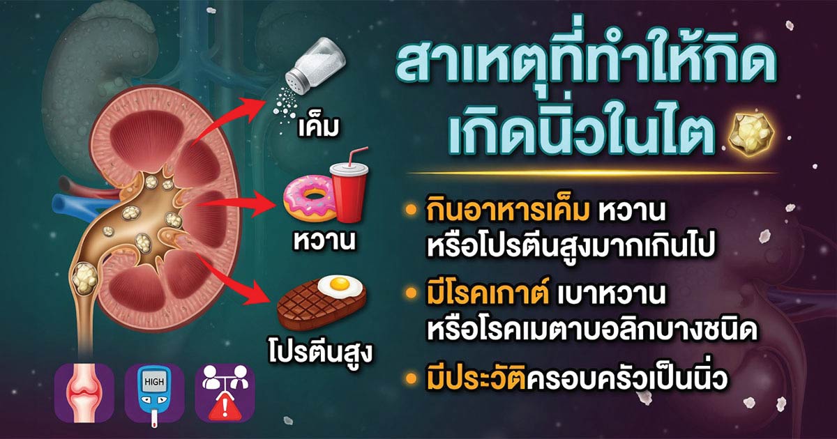 ผู้ป่วยที่เหมาะกับการสลายนิ่ว ESWL