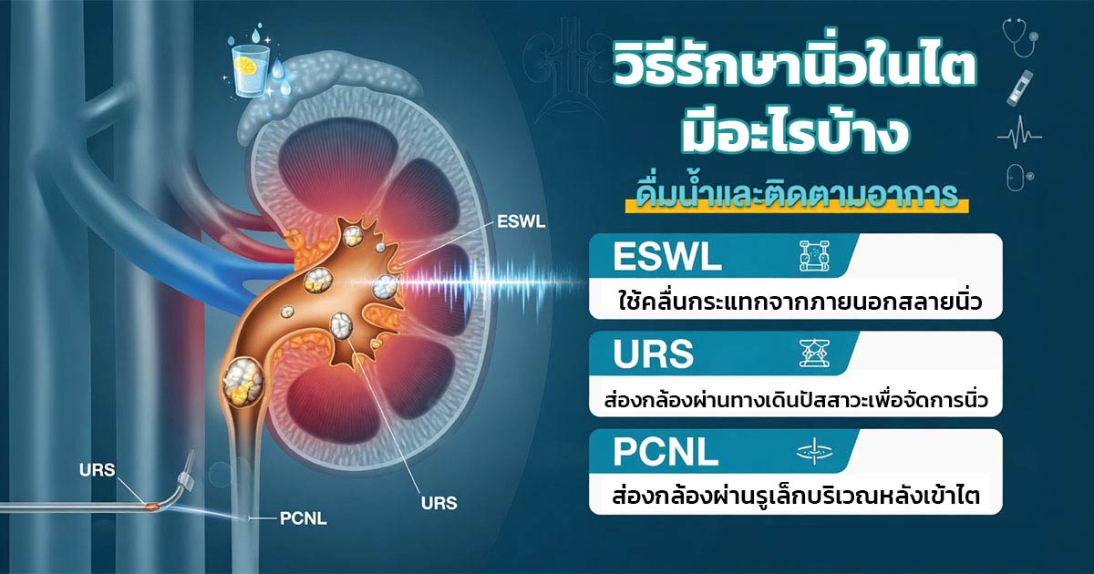 วิธีรักษานิ่วในไตแต่ละรูปแบบ
