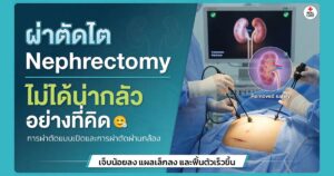 ผ่าตัดไต