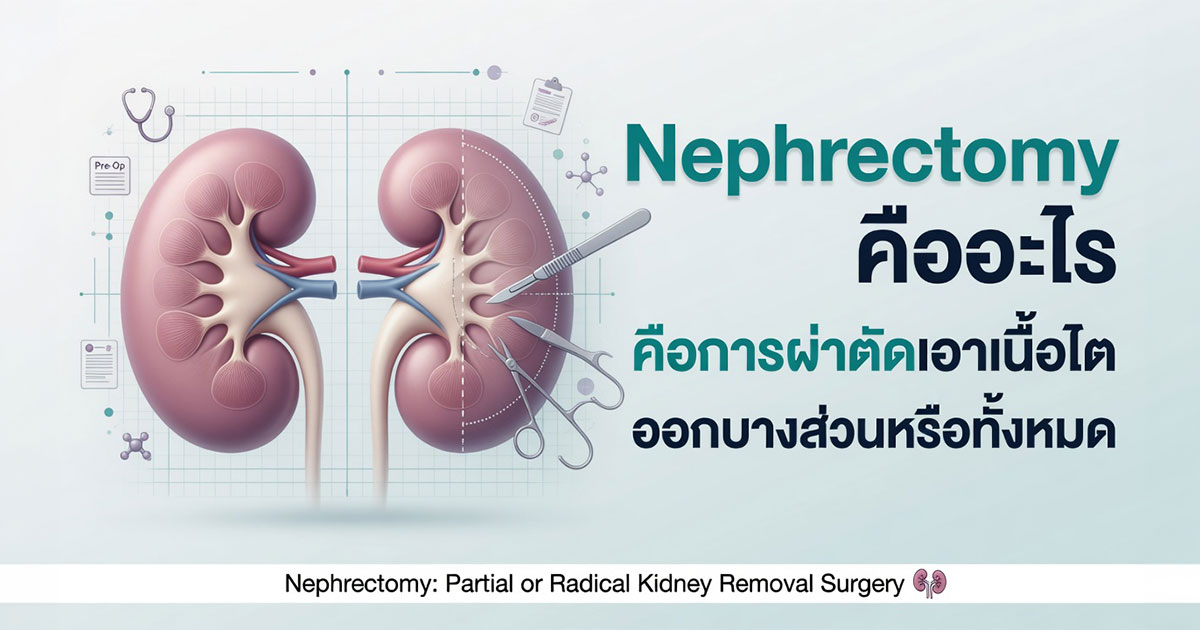 ผ่าตัดไต Nephrectomy