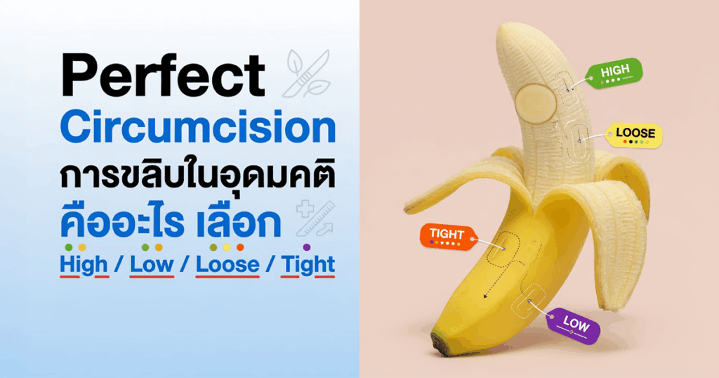Perfect Circumcision การขลิบในอุดมคติ คืออะไร เลือก High Low Loose Tight อย่างไรให้เหมาะกับตัวเอง - ETERNITY CLINIC นพ.สืบพงษ์ เอ่งฉ้วน Perfect Circumcision