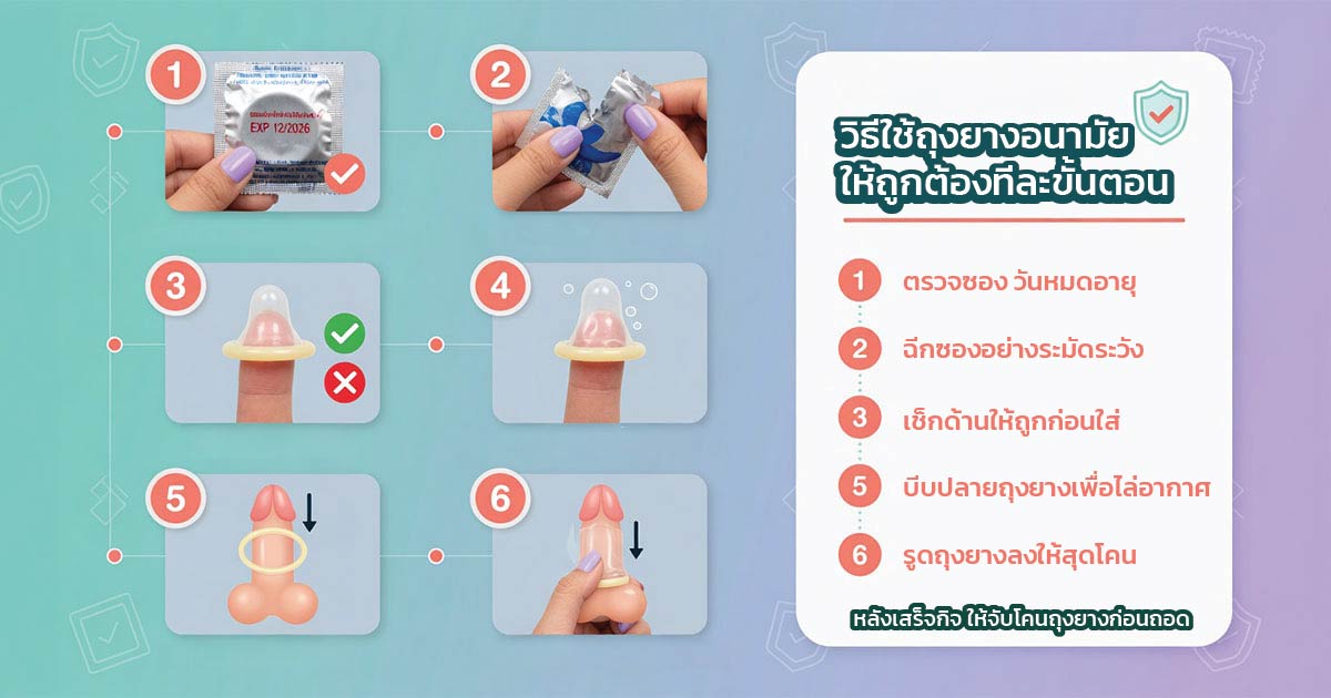 วิธีใส่ถุงยางอนามัยให้ถูกต้องทีละขั้นตอน