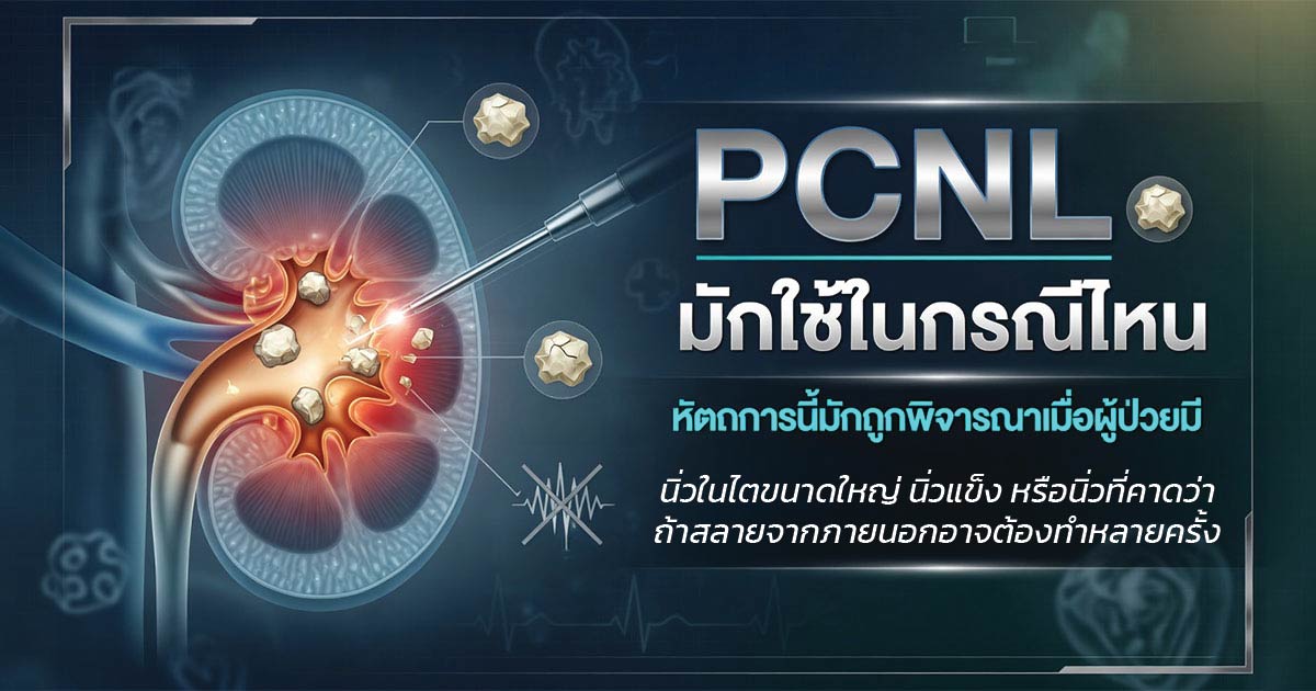 กรณีที่อาจเหมาะกับการรักษานิ่วในไตด้วย PCNL