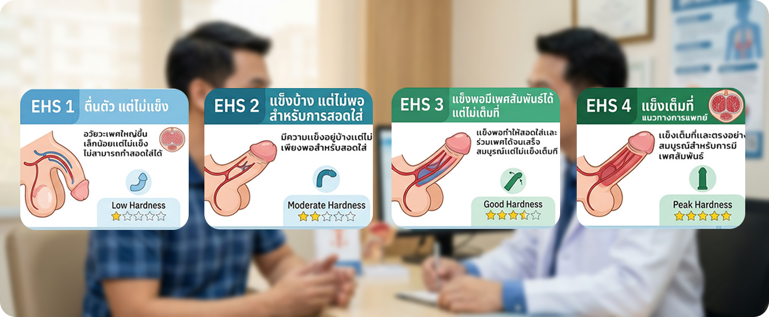 ระดับความแข็งตัวของอวัยวะเพศชาย EHS 1 ถึง EHS 4