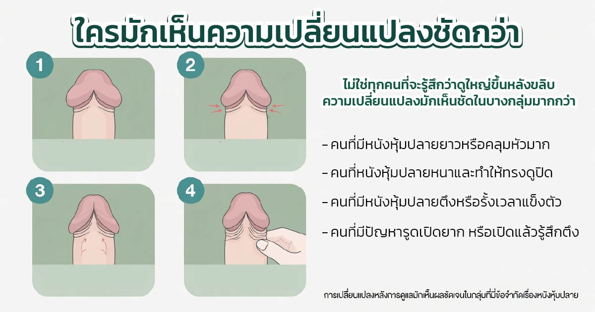 ทำไมหลังขลิบบางคนรู้สึกว่าดูใหญ่ขึ้น