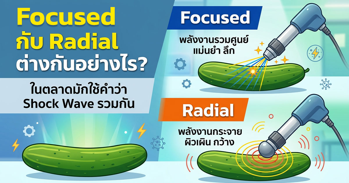 คำอธิบายรูปตามหัวข้อบทความ