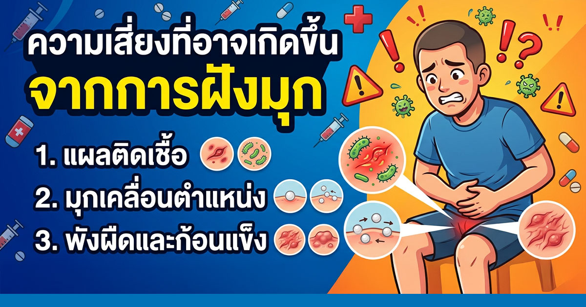 คำอธิบายรูปตามหัวข้อบทความ