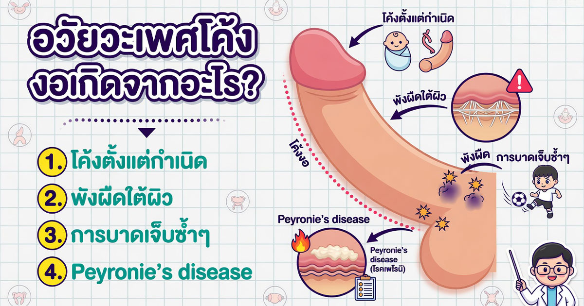 คำอธิบายรูปตามหัวข้อบทความ