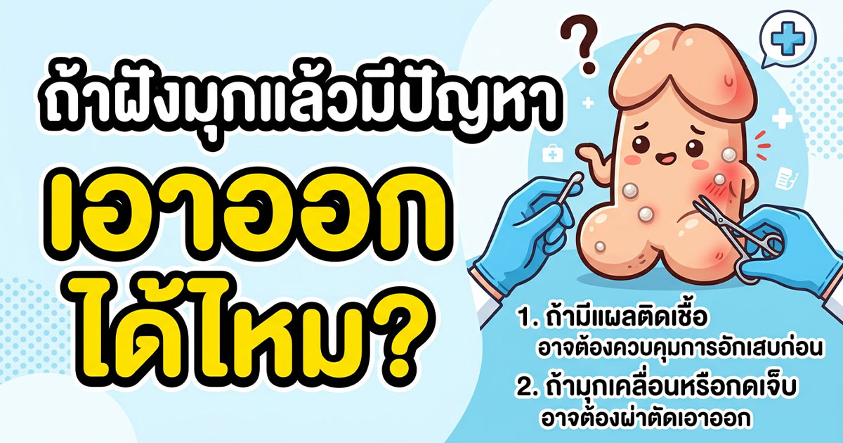 คำอธิบายรูปตามหัวข้อบทความ