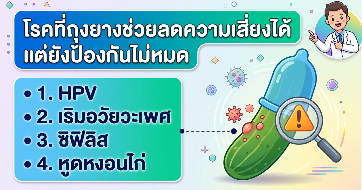 คำอธิบายรูปตามหัวข้อบทความ