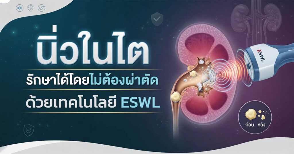 frown - ETERNITY CLINIC นพ.สืบพงษ์ เอ่งฉ้วน นิ่วในไต