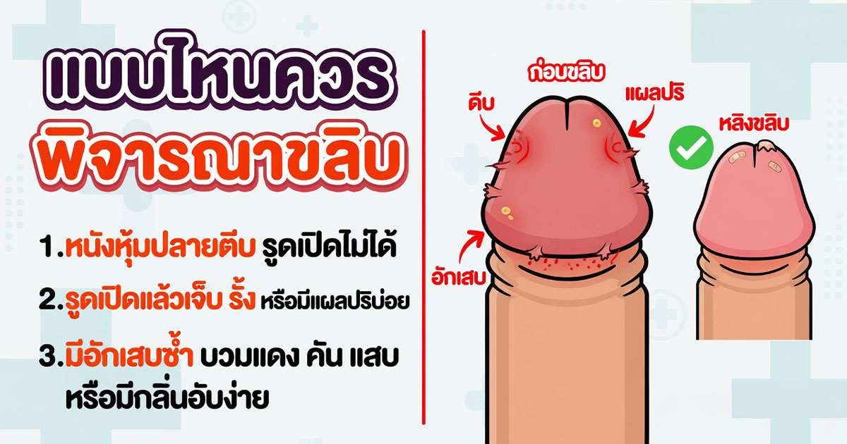 คำอธิบายรูปตามหัวข้อบทความ