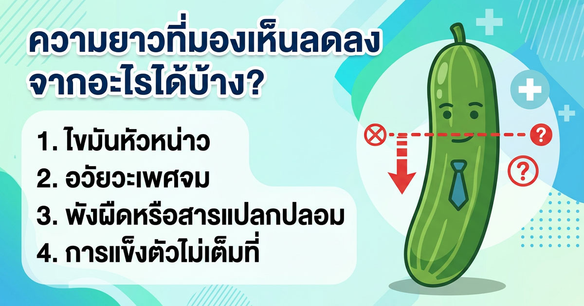 คำอธิบายรูปตามหัวข้อบทความ