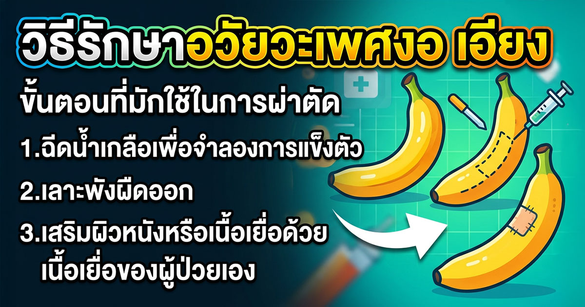 Chordee แบบไหนควรพบแพทย์