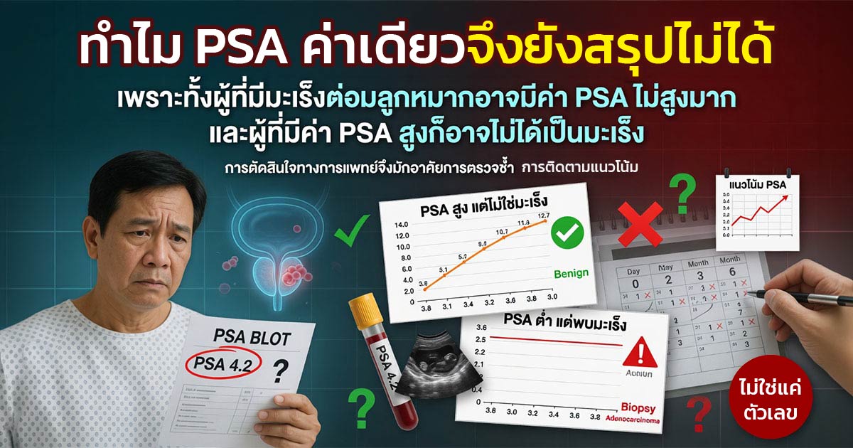 ค่า PSA สูงอาจเกิดจากหลายสาเหตุ ไม่ได้หมายถึงมะเร็งต่อมลูกหมากเสมอไป