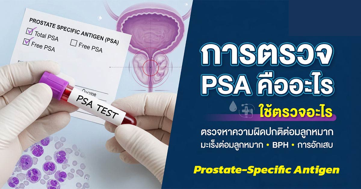 การตรวจเลือด PSA เพื่อประเมินสุขภาพต่อมลูกหมาก