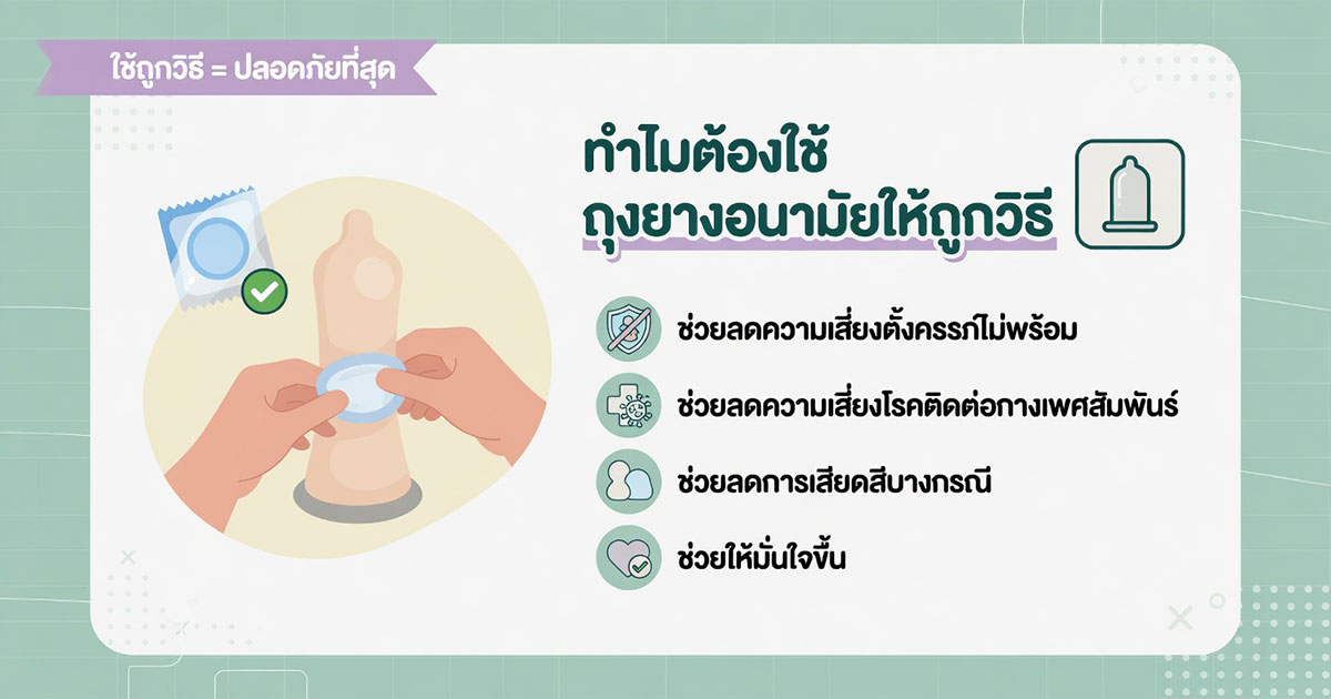 การใช้ถุงยางอนามัยอย่างปลอดภัยช่วยลดความเสี่ยงทางเพศ