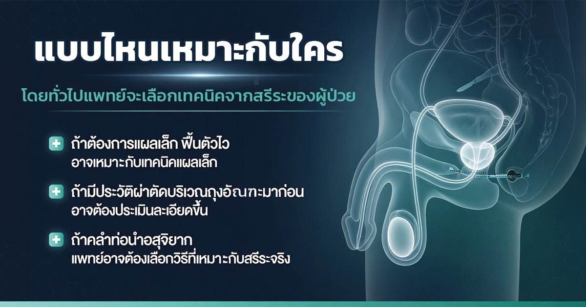 การประเมินความเหมาะสมก่อนเลือกวิธีทำหมันชาย