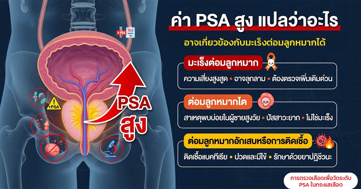 ขั้นตอนการตรวจ PSA เป็นการตรวจเลือดเพื่อวัดระดับโปรตีนจากต่อมลูกหมาก