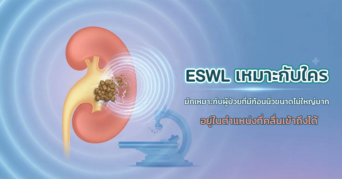 การรักษานิ่วด้วยเทคโนโลยี ESWL
