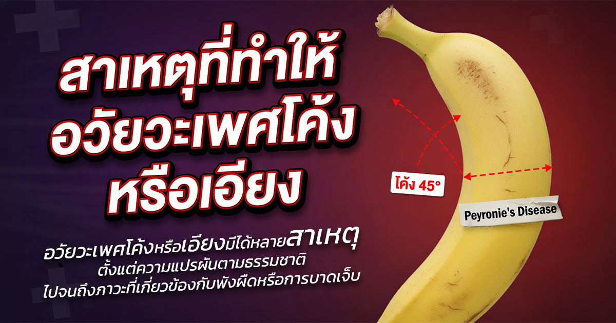 คำอธิบายรูปตามหัวข้อบทความ