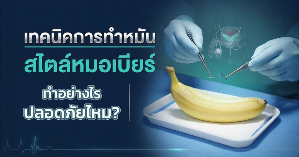 Dr beer - ETERNITY CLINIC นพ.สืบพงษ์ เอ่งฉ้วน การทำหมันของหมอเบียร์