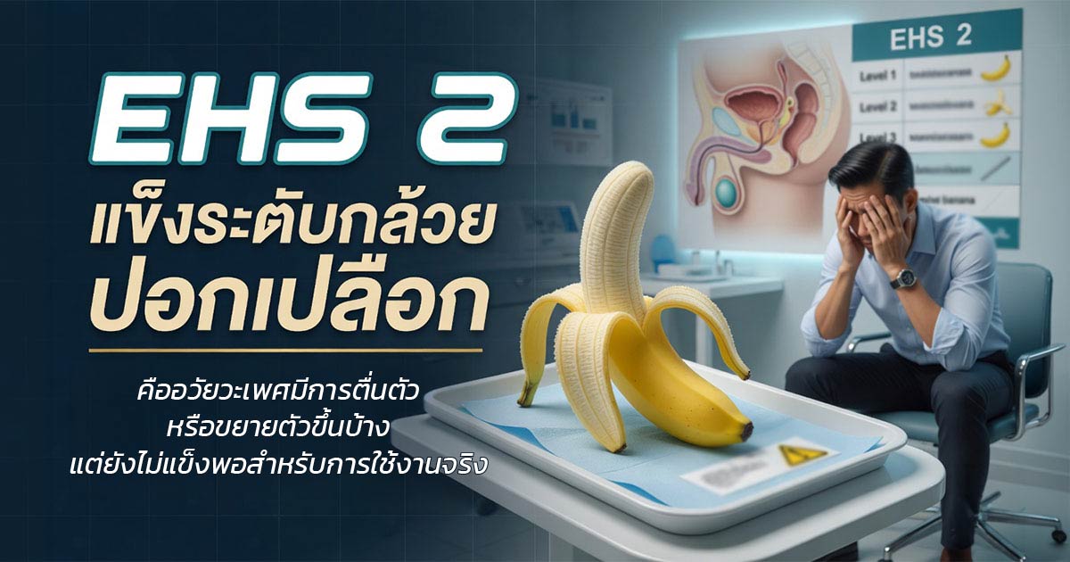 คำอธิบายรูปตามหัวข้อบทความ