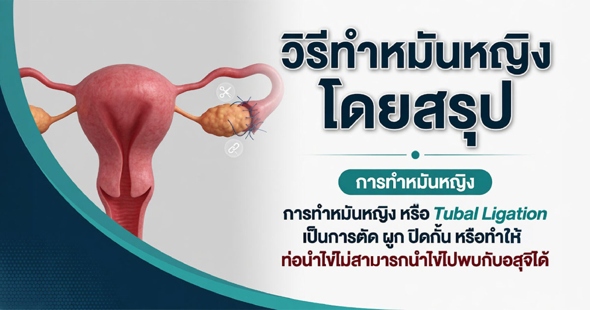คำอธิบายรูปตามหัวข้อบทความ