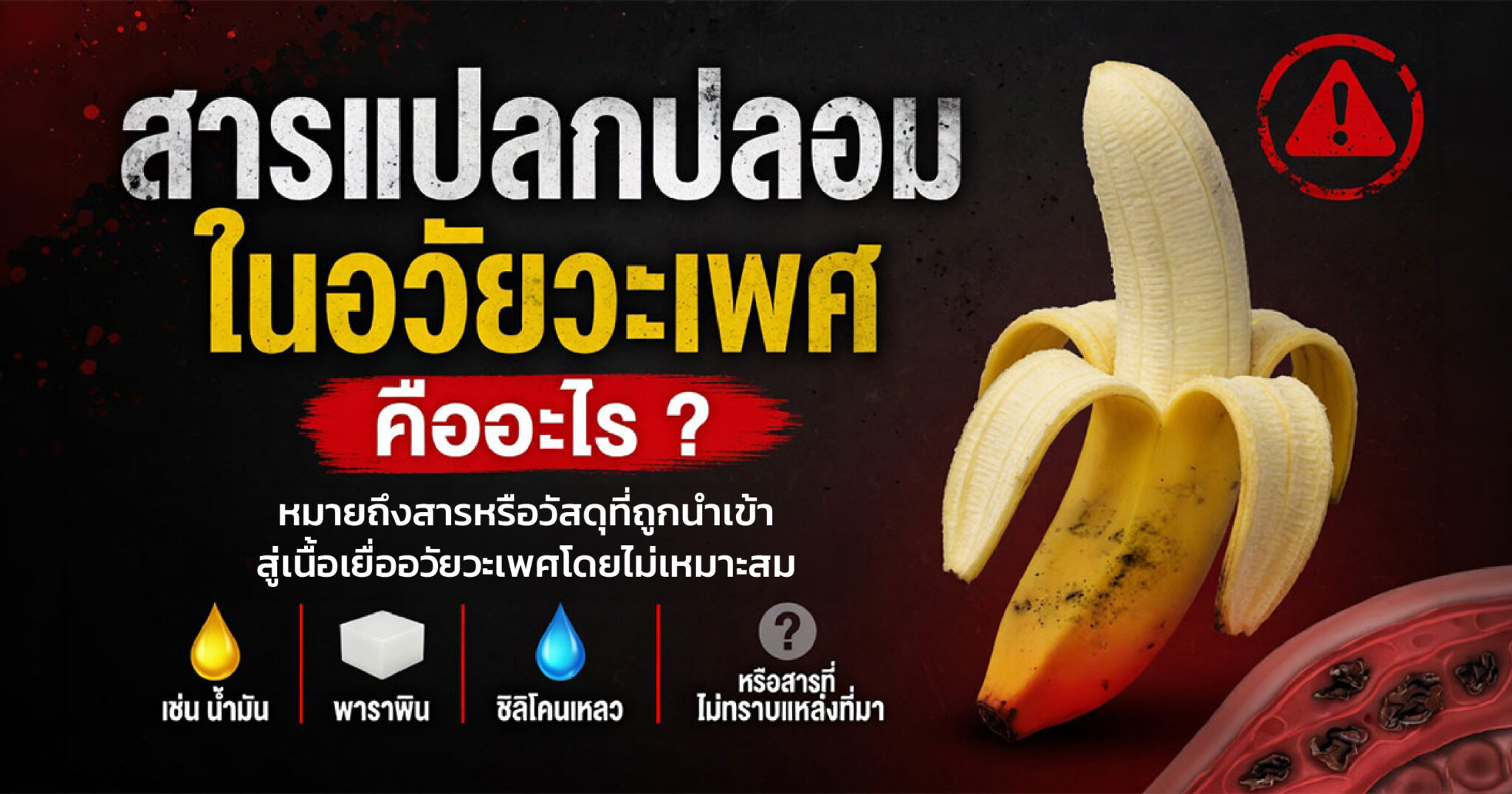 คำอธิบายรูปตามหัวข้อบทความ