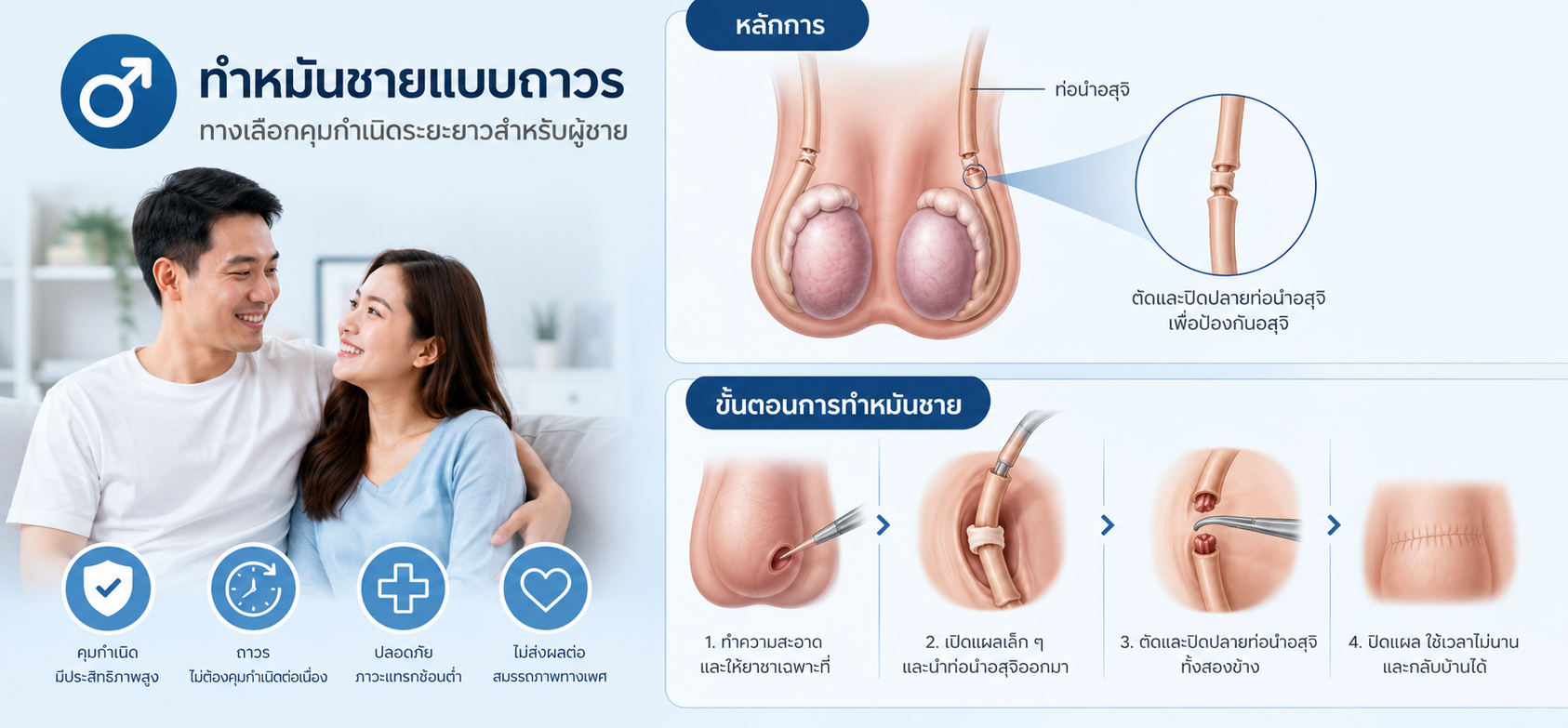 ทำหมันชาย Vasectomy ขั้นตอน ตรวจน้ำเชื้อ และข้อควรรู้ก่อนตัดสินใจ
